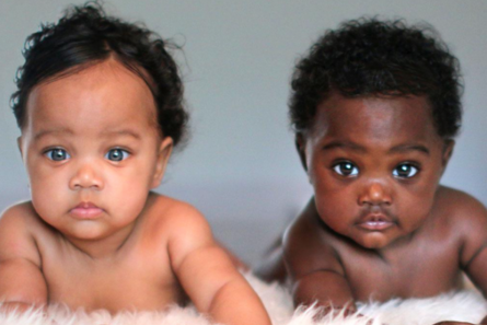 These twins are proof that being black is magical