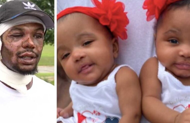 Michigan Father Ray Lucas Suffers Severe Burns after Rescuing Twin Daughters from House Fire
